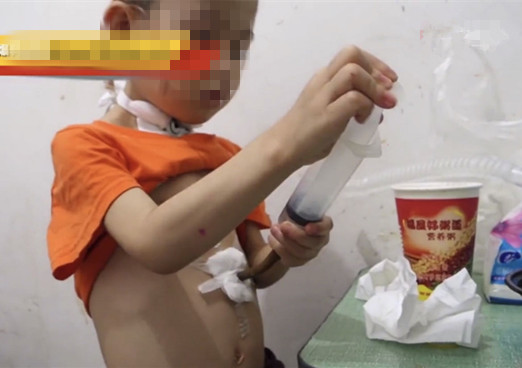 高锰酸钾儿童误食的后果,高锰酸钾孩子误食了咋办