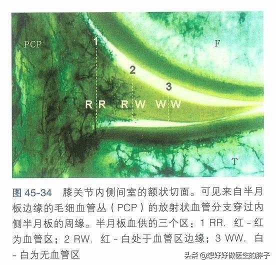 膝盖半月板撕裂还可以跑步吗,半月板撕裂未触及关节面能自愈吗