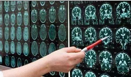 x光b超ct核磁共振区别,ctx光和b超核磁共振的区别