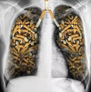 呼吸不顺畅但是ct没问题,呼吸不顺畅需要做心脏彩超吗