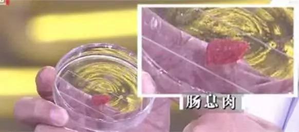 大便前面硬后稀警惕这五种疾病,大便先硬黑后稀黄怎么回事