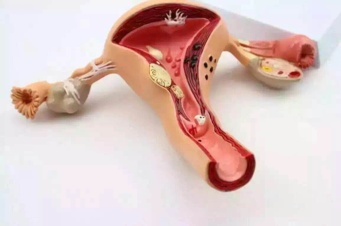 彻底解决妇科疾病的药,女性妇科防治知识大全