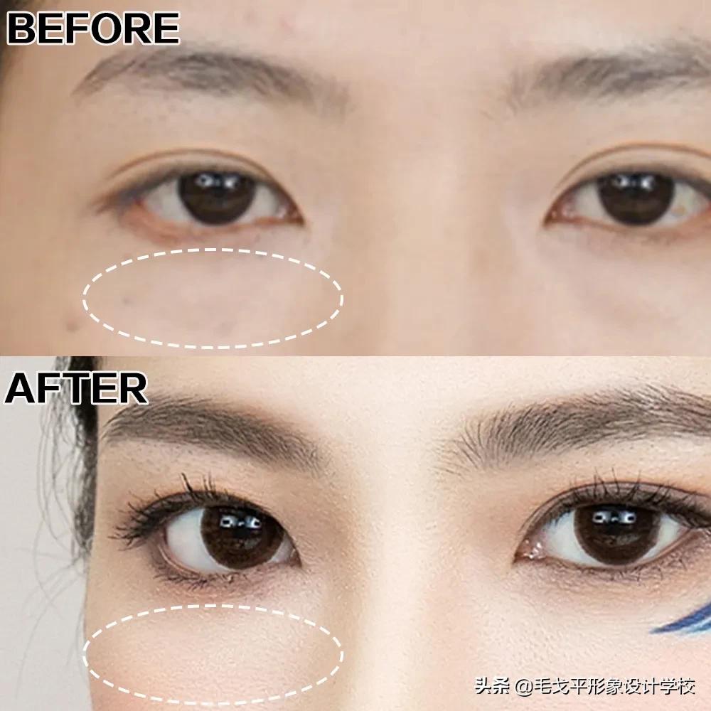 后期如何提升脸部平整度,凹陷脸如何变饱满