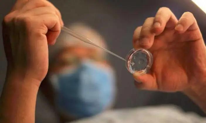 我的卵子是怎么排出来的,我的卵子没精子怎么办