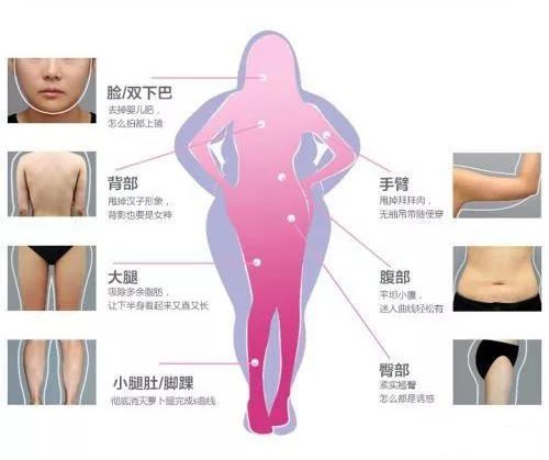 去做吸脂手术都咋想的,想抽脂需要了解的事项