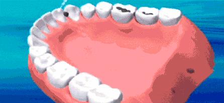 牙科不告诉你去牙结石的秘密,牙结石科普