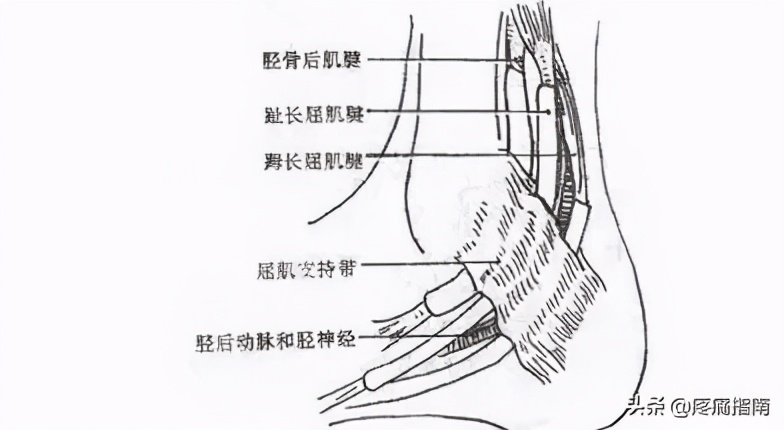 踝管综合征针刀视频,针刀松解术治踝管综合征效果好吗
