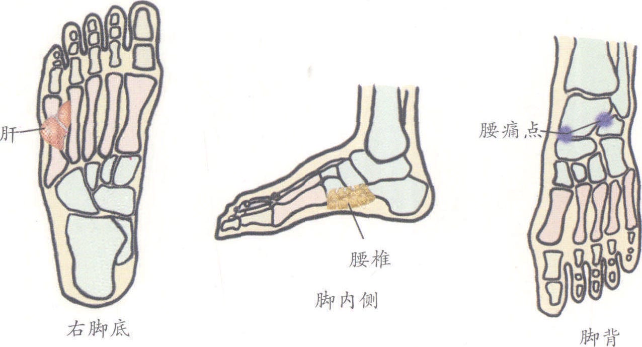 腰椎开裂腰痛的最快治疗方法,腰椎增生导致腰疼怎么理疗
