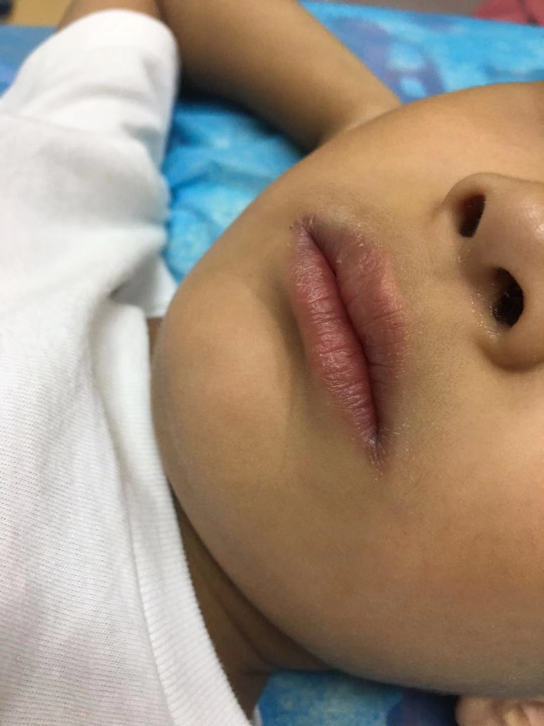 孩子高烧不退，退烧药效果不佳，只能硬抗吗？