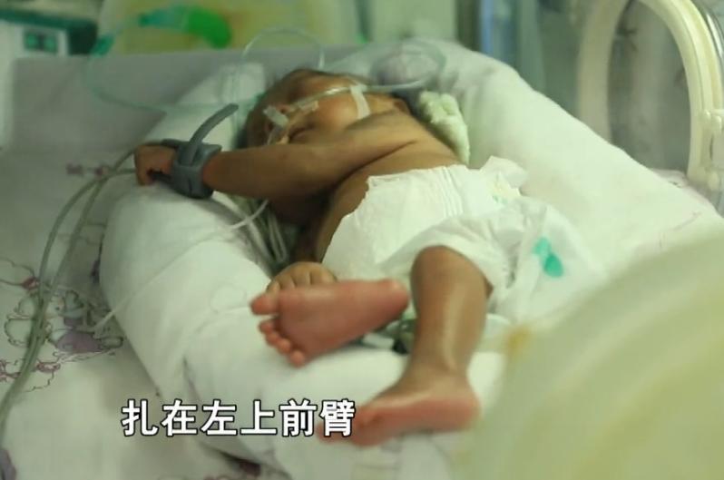 婴儿胳膊突然肿了,宝宝手臂肿了一块鼓起来