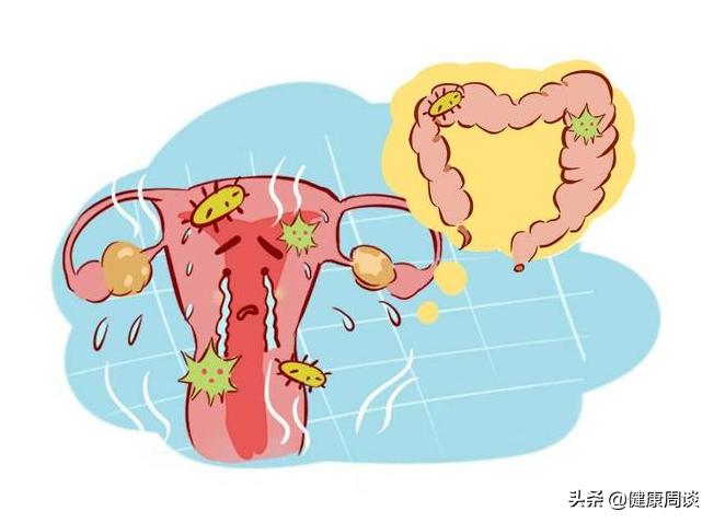 提醒女性：身体无端端出现4种迹象，千万别拖，尽快去医院排查HPV