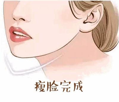 打了三次瘦脸针想告诉你这些真相,刚打了瘦脸针后悔了有补救吗