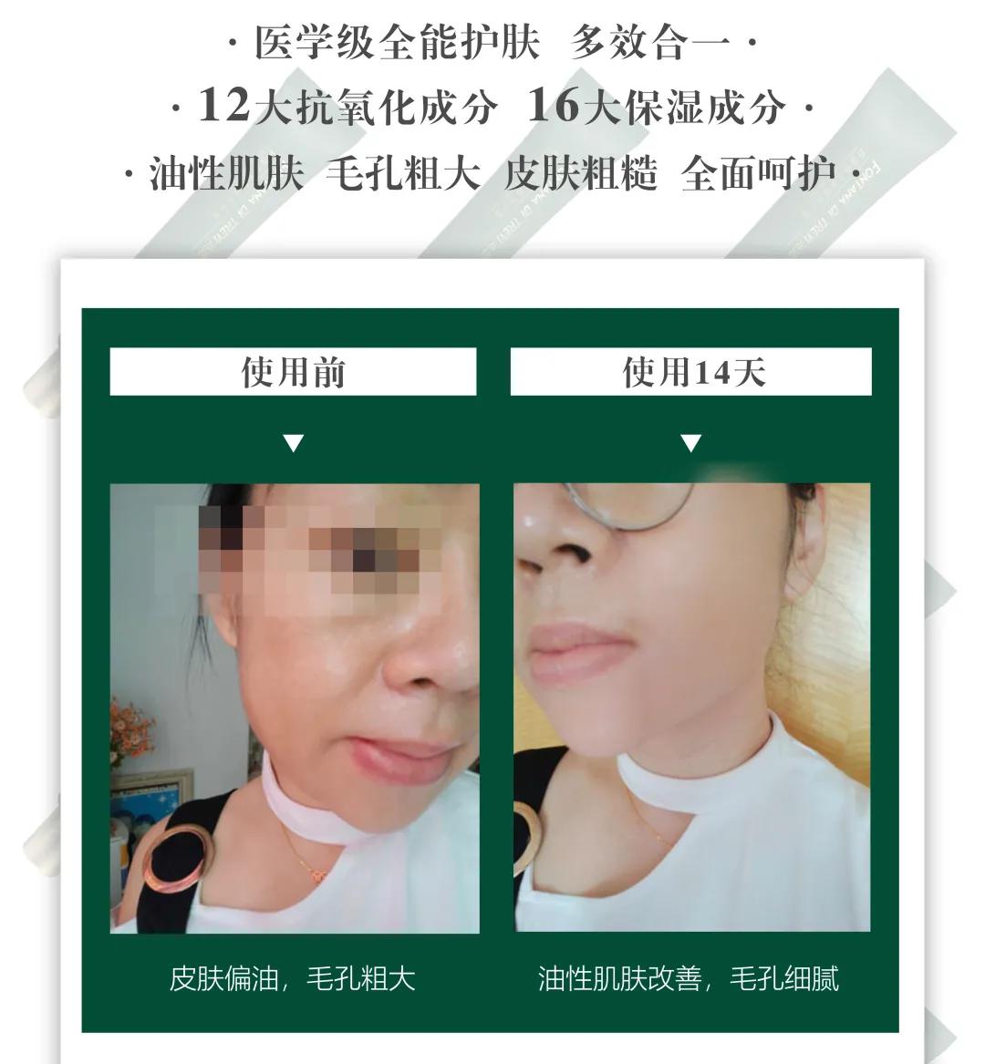 肌肤发红发痒怎么护理,泛红刺痛干痒如何修复