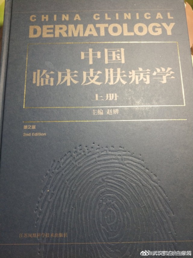 防治白癜风全面升级,武汉北大白癜风医院看白癜风