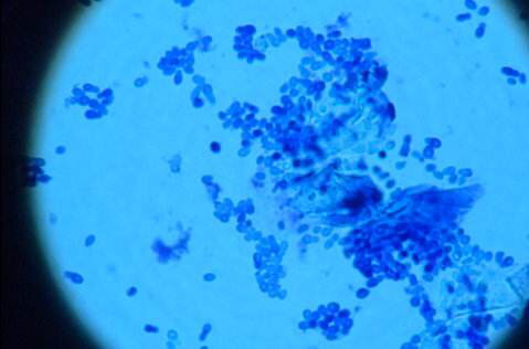 最快解决猫耳螨的办法,你真的了解你家猫咪吗