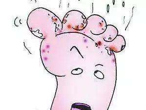 痒！痒！痒！这个扬州人忍了半个多月，后悔了