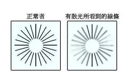 散光75度有必要矫正吗,散光最严重的看散光表是什么感觉