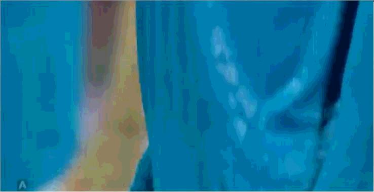 c罗为什么是电梯球,为什么c罗任意球进得少了