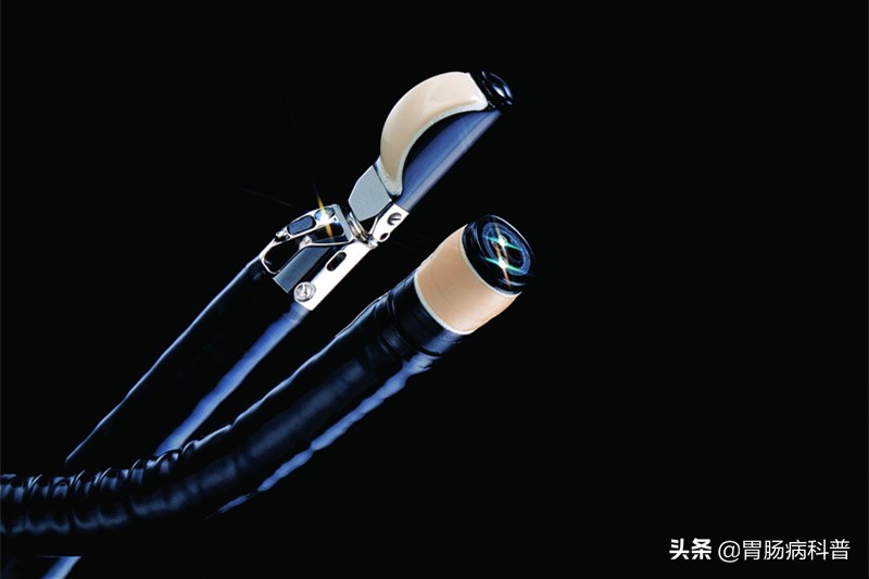 消化内镜发展现状,上消化道超声内镜临床应用