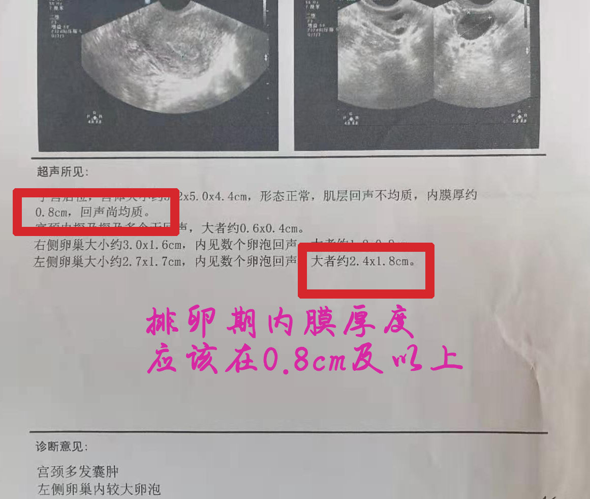 子宫内膜薄产后会内膜厚吗,人流后多年发现子宫内膜厚薄不均