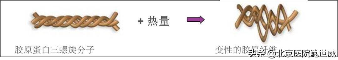 了解抗衰老护肤品,热玛吉抗衰2019