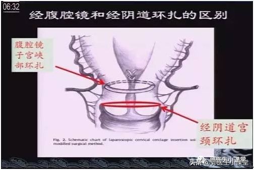 流产7次还能流产吗,怀孕10次流产10次