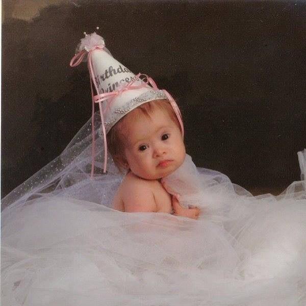 唐氏综合症少女模特,唐氏综合征女孩被美国收养