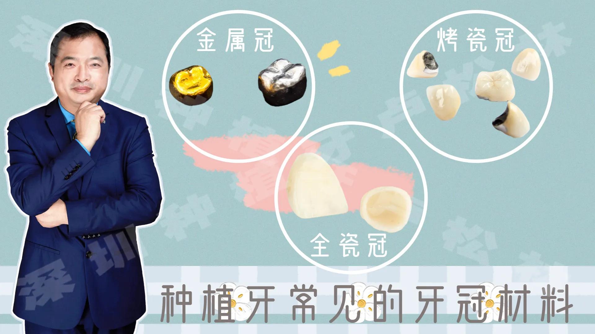 非要做牙冠吗,每个人都能做种植牙吗