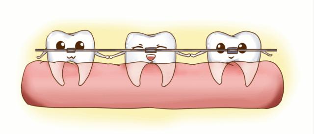 牙齿矫正打骨钉后注意事项,牙齿矫正取下牙套需要注意什么
