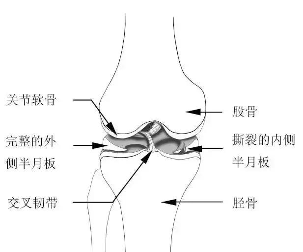 全世界公认膝关节锻炼三个动作,国外康复师康复膝盖的四个动作