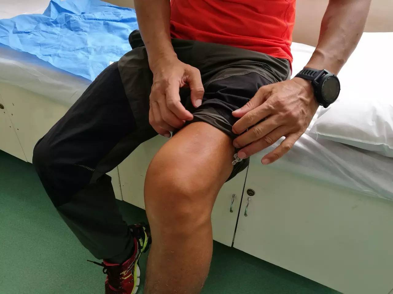 膝关节囊积液包括髌上囊积液吗,左膝关节少量积液髌上囊少量积液