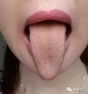 舌头是人体自带的体检表，一旦出现这个信号，马上去医院
