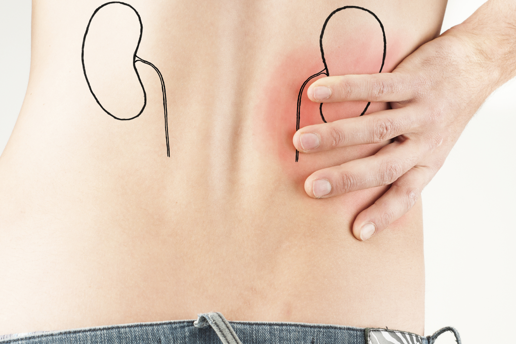 有黑眼圈可以吃补肾补肝的药吗,老中医治黑眼圈偏方