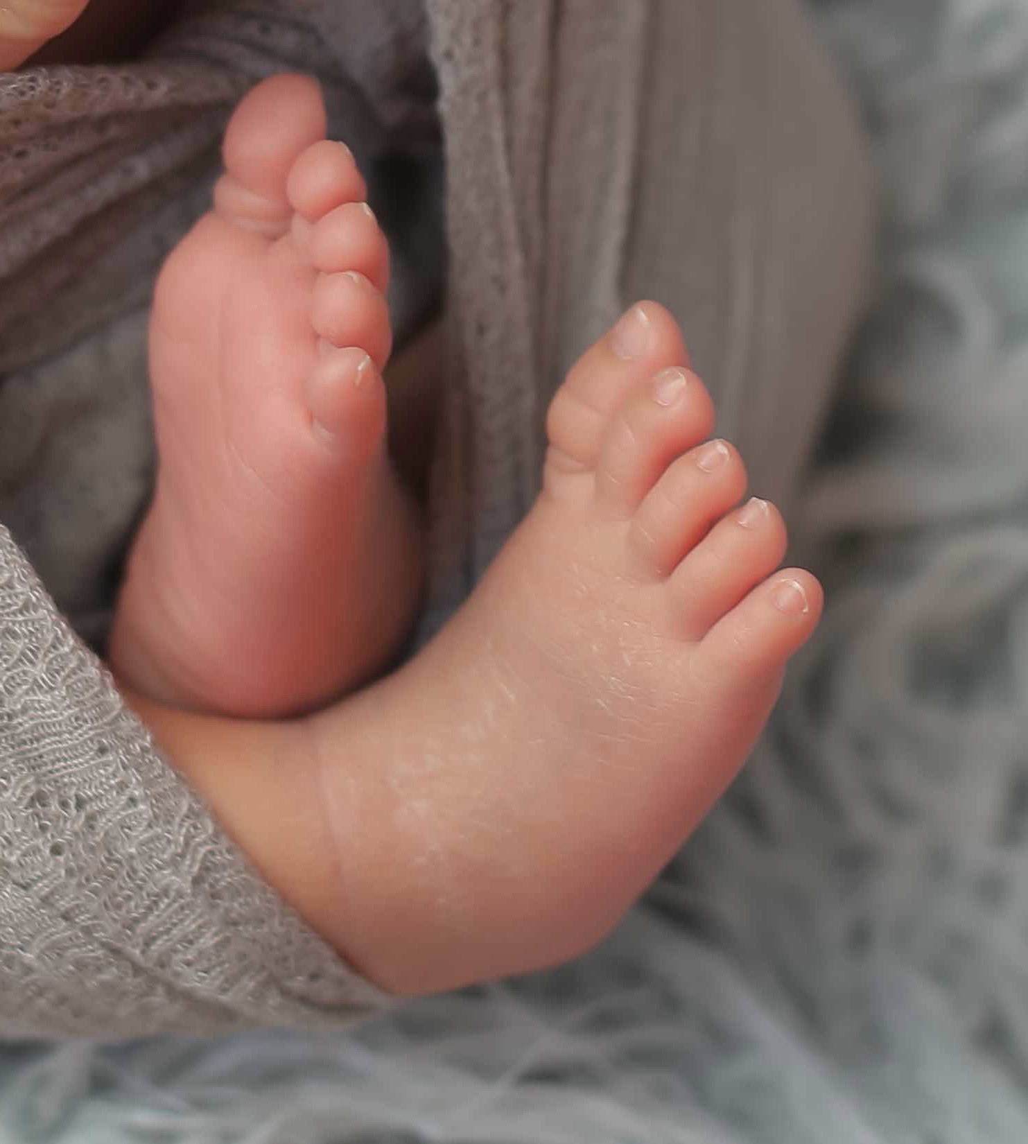 宝宝染上黄疸怎么办？