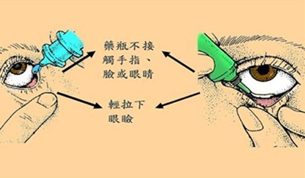 眼药使用注意事项，避免副作用