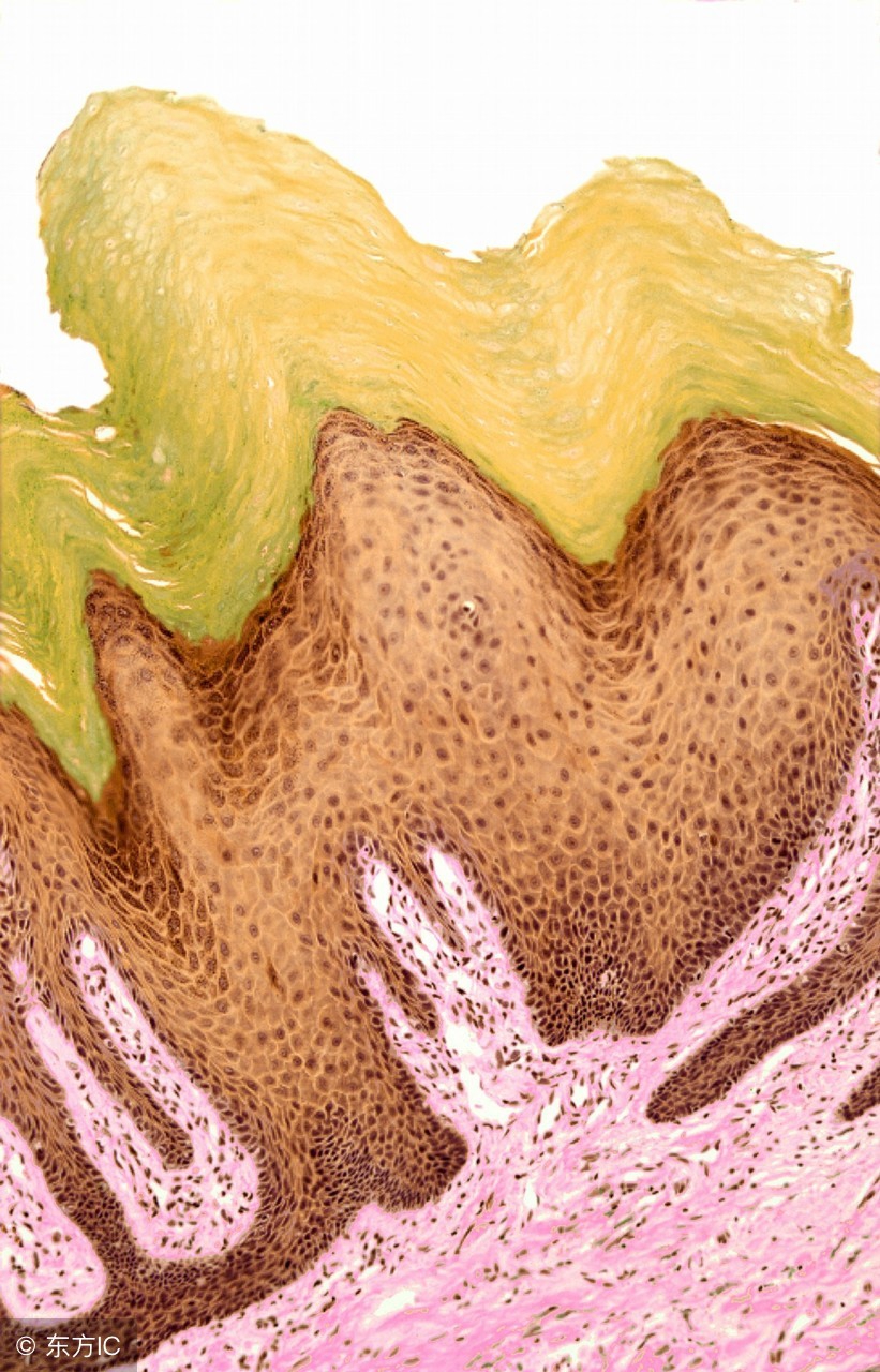 寻常疣和扁平疣区别,头皮上扁平疣和寻常疣的区别