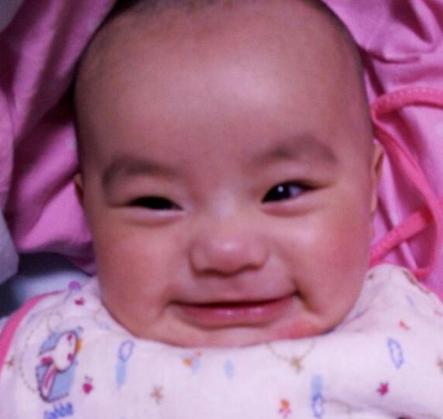 宝宝得了口水疹,口水疹可以抹口水疹膏吗