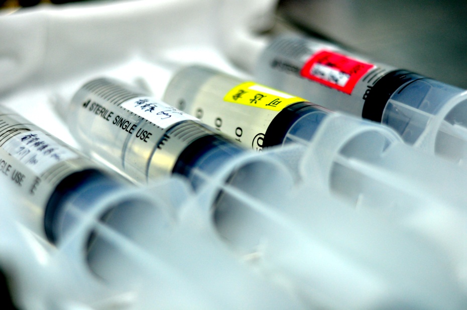 立体定向脑干血肿清除术,脑干血肿清除术