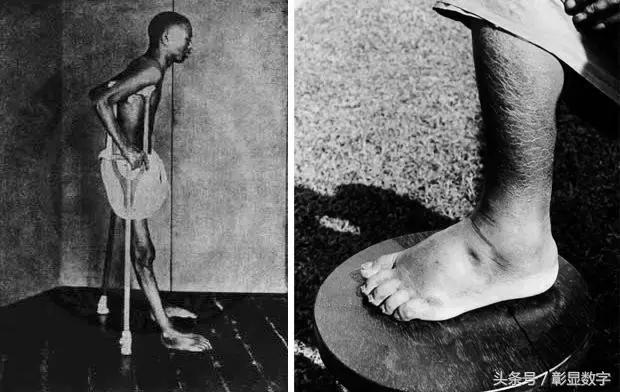 大瓶维生素c是不是智商税,疯狂补维c