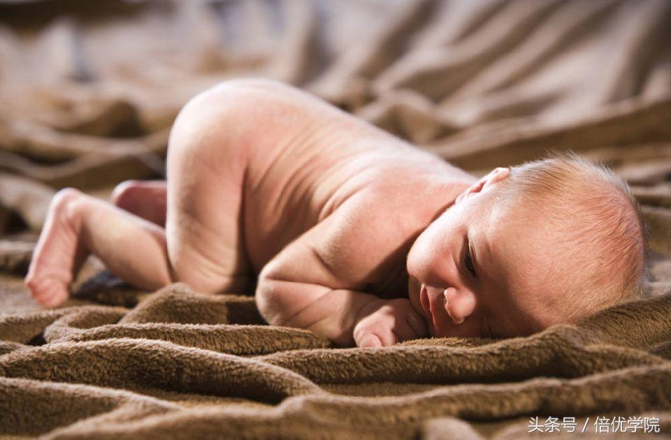 婴儿黄疸最简单的解决方法,宝宝黄疸怎么避免