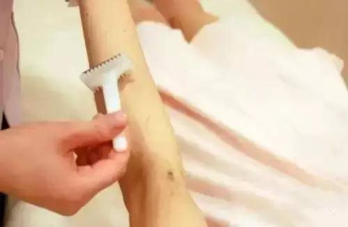 脱毛之后，夏天谁还不是个小仙女咋地！