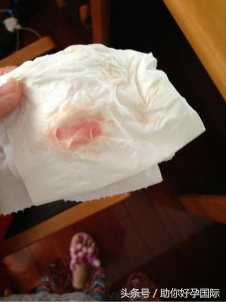 孕早期出血是胎停了吗,孕早期出血就是着床出血吗