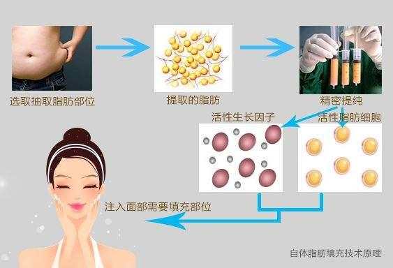 2022最火的除皱方式,目前除皱最安全有效的方法