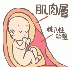 人工流产对女性伤害有多深,人工流产的危害有多大