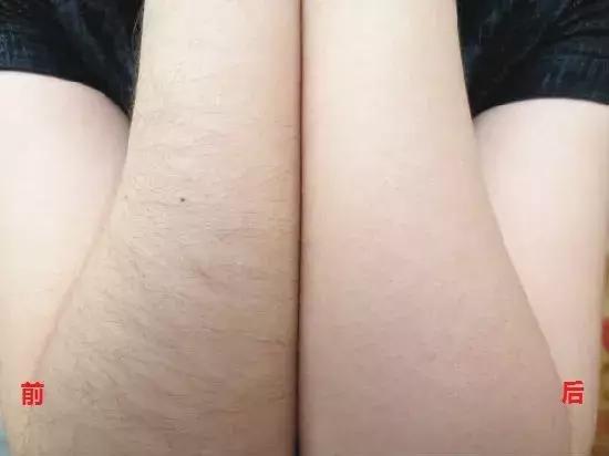 1秒脱毛,如何在一分钟内脱毛