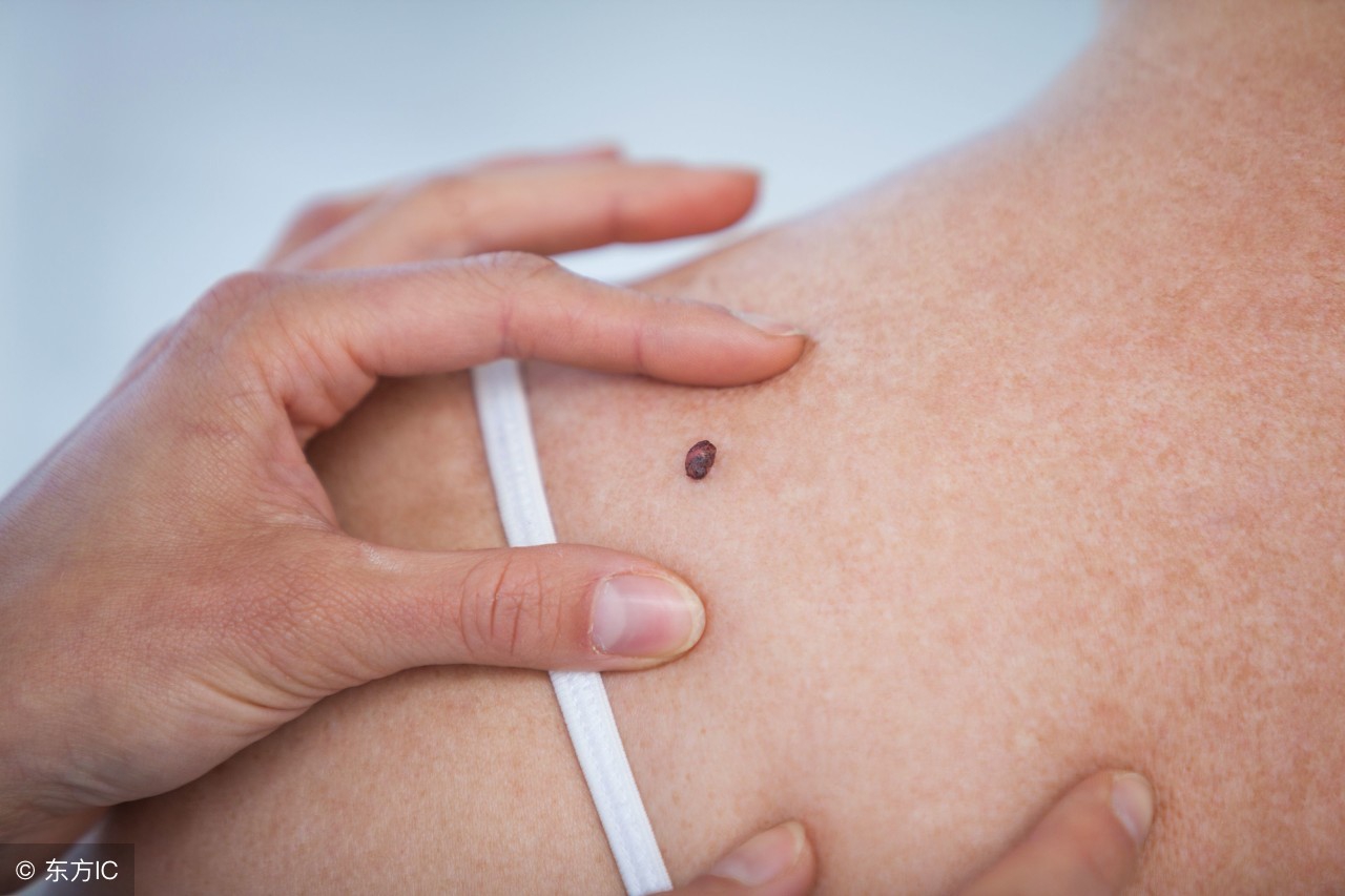 这4种疾病是“隐形癌症”，如果不及时治疗，真的会变成癌症