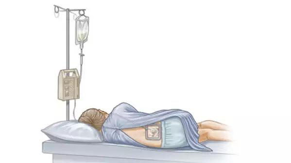 丈夫拒绝无痛分娩妻子独自在产房,丈夫拒绝无痛分娩完整版