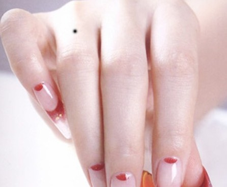 不同的的痣都代表什么,不同位置的痣的面相