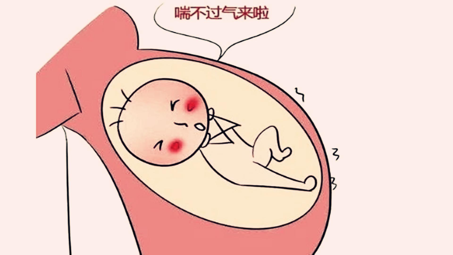 孕期要警惕4种胎动异常,孕期胎儿胎动大原因有哪些