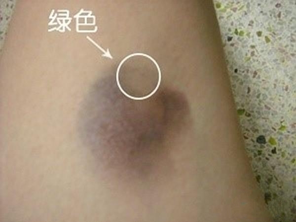 装病请假必备技巧